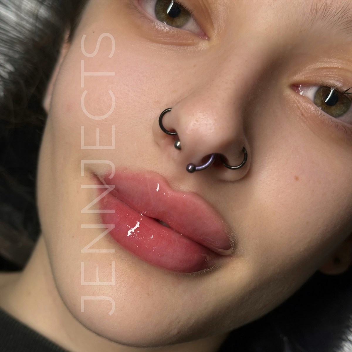 Aesthetic World & Med Spa